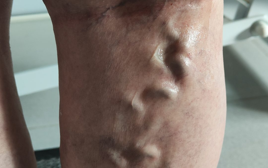 Scleromousse ecoguidata